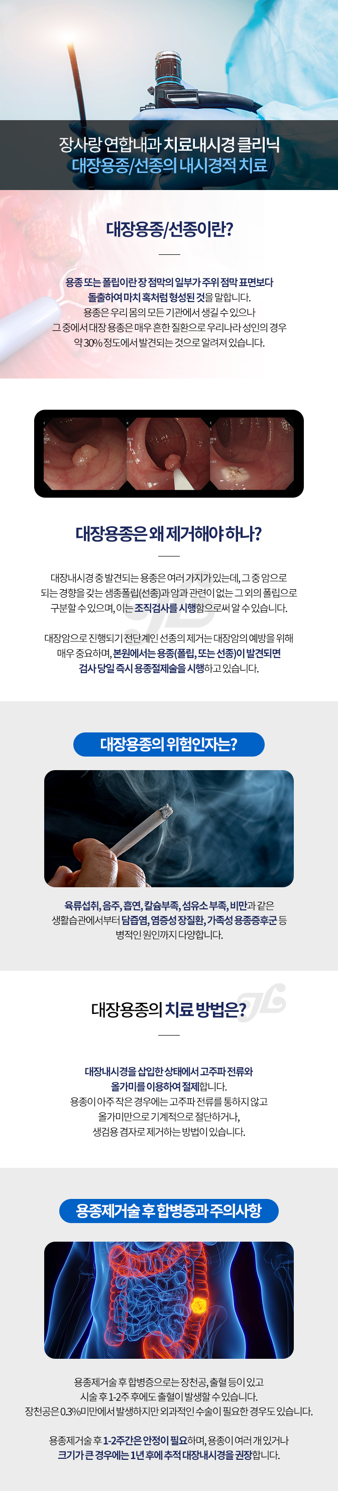 대장용종제거술