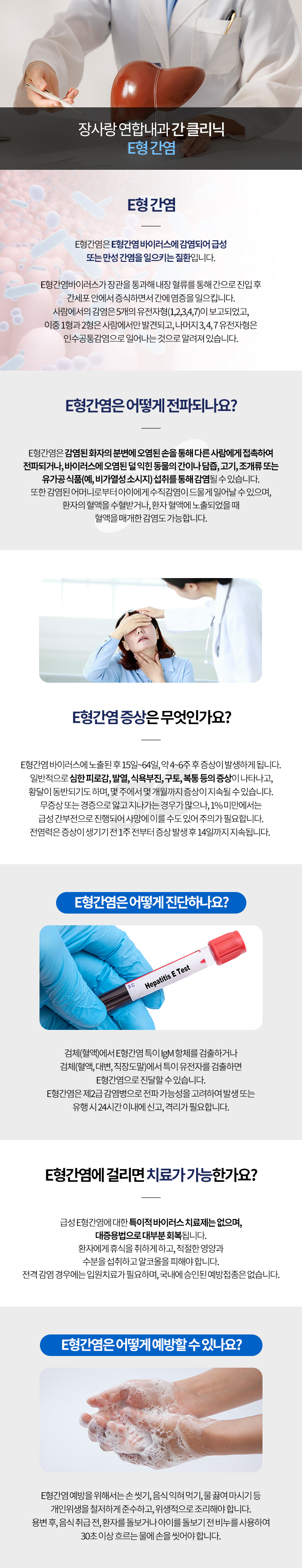 E형 간염